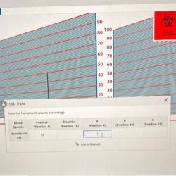 Blood hematocrit lab measure simulation laboratory